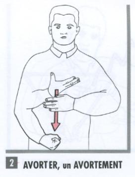 Avortement.jpg