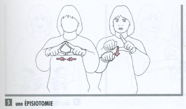 Episiotomie.jpg