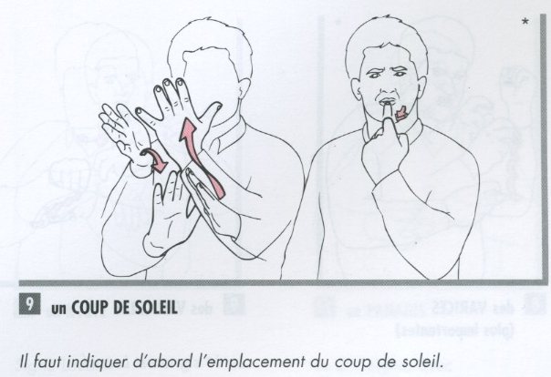 Coup de soleil.jpg